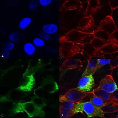 Immunocytochemistry/ Immunofluorescence: SCN3B Antibody (S396-29) [NBP2-59318]