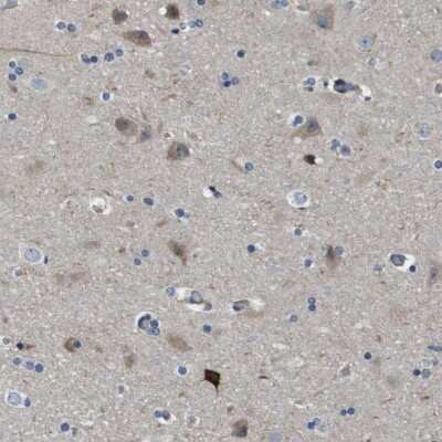 Immunohistochemistry-Paraffin: SCN4B Antibody [NBP1-86057]