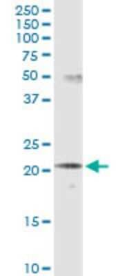 Western Blot: SCNM1 Antibody (1E10) [H00079005-M01]