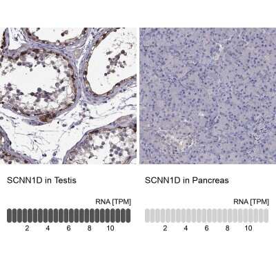 Immunohistochemistry-Paraffin: SCNN1D Antibody [NBP1-85004]