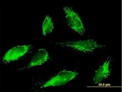 Immunocytochemistry/ Immunofluorescence: SCO1 Antibody [H00006341-B01P]