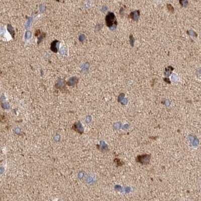 Immunohistochemistry-Paraffin: SCO1 Antibody [NBP1-87074]