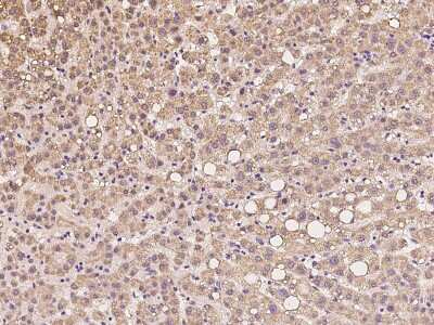 Immunohistochemistry-Paraffin: SCO1 Antibody [NBP2-97289]