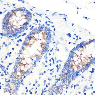 Immunohistochemistry-Paraffin: SCO2 Antibody - Azide and BSA Free [NBP2-94525]