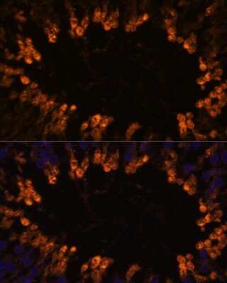 Immunohistochemistry: SCOT2 Antibody - Azide and BSA Free [NBP2-93673]