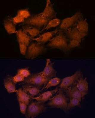 Immunocytochemistry/ Immunofluorescence: SCP2/SYCP2 Antibody - Azide and BSA Free [NBP2-94045]
