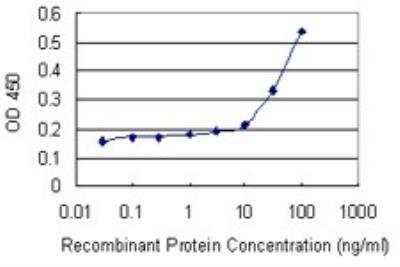 ELISA: SCP2D1 Antibody (3C11) [H00140856-M01]