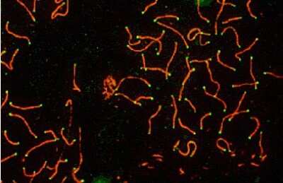 Immunocytochemistry/ Immunofluorescence: SCP3/SYCP3 Antibody [NB300-231]