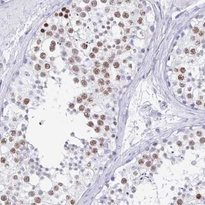 Immunohistochemistry-Paraffin: SCP3/SYCP3 Antibody [NBP2-48713]