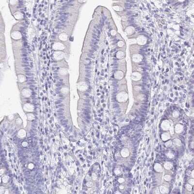 Immunohistochemistry-Paraffin: SCP3/SYCP3 Antibody [NBP2-48713]