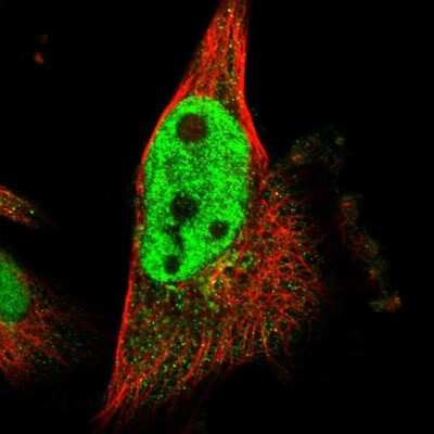 Immunocytochemistry/ Immunofluorescence: SCRN2 Antibody [NBP1-85994]