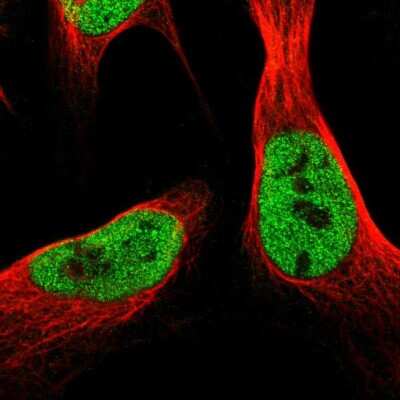 Immunocytochemistry/ Immunofluorescence: SCRN2 Antibody [NBP1-86419]
