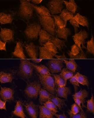 Immunocytochemistry/ Immunofluorescence: SCRN3 Antibody - Azide and BSA Free [NBP2-93639]