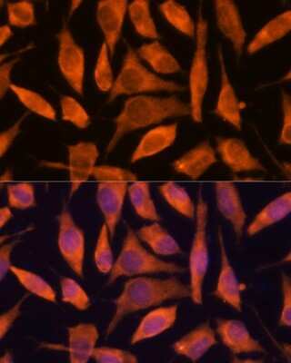 Immunocytochemistry/ Immunofluorescence: SCRN3 Antibody - Azide and BSA Free [NBP2-93639]