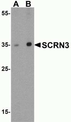 Western Blot: SCRN3 AntibodyBSA Free [NBP2-82003]