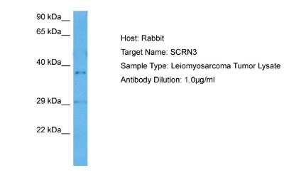 Western Blot: SCRN3 Antibody [NBP2-85699]
