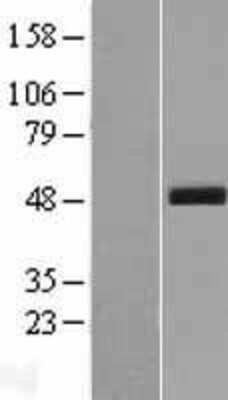 Western Blot: SCRN3 Overexpression Lysate [NBP2-06317]
