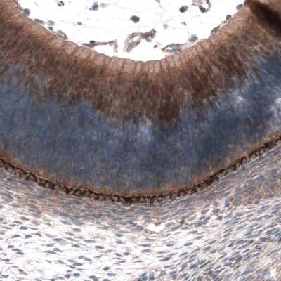 Immunohistochemistry-Paraffin: SCRT1 Antibody [NBP1-92369]