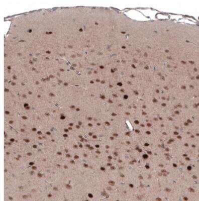 Immunohistochemistry-Paraffin: SCRT1 Antibody [NBP1-92369]
