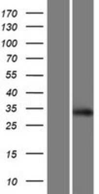 Western Blot: SCRT2 Overexpression Lysate [NBP2-05907]