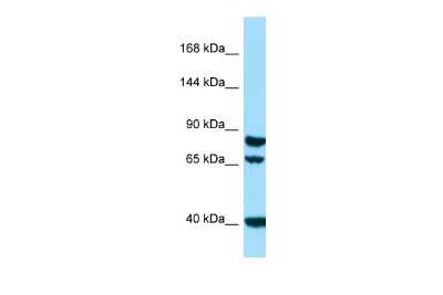 Western Blot: SCUBE1 Antibody [NBP2-85701]