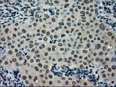 Immunohistochemistry-Paraffin: SCY1 like 3 Antibody (OTI1A5) [NBP1-47956]