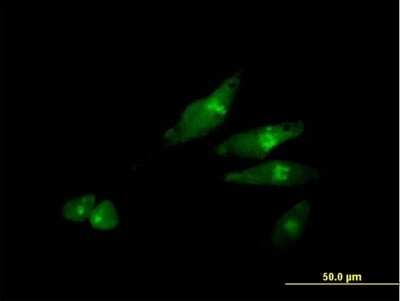 Immunocytochemistry/ Immunofluorescence: SCY1 like 3 Antibody [H00057147-B01P]