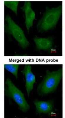 Immunocytochemistry/ Immunofluorescence: SCY1 like 3 Antibody [NBP1-33190]
