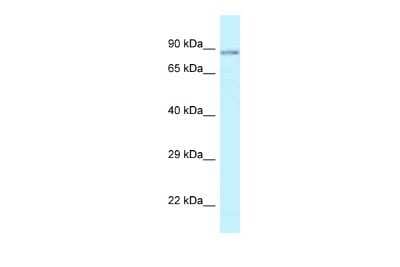 Western Blot: SCYL1 Antibody [NBP2-88225]