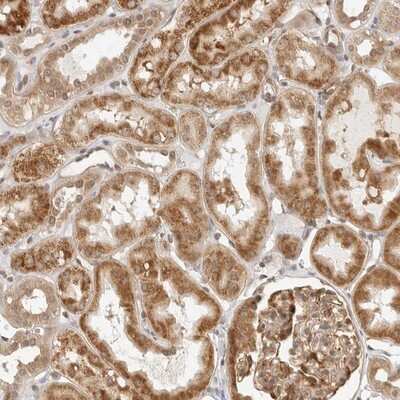 Immunohistochemistry-Paraffin: SCYL1BP1 Antibody [NBP1-92370]
