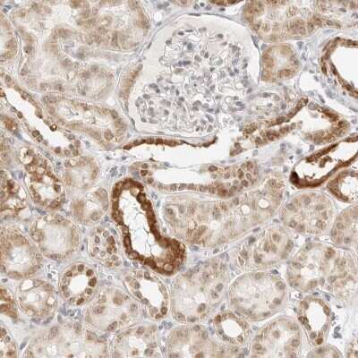 Immunohistochemistry-Paraffin: SCYL1BP1 Antibody [NBP1-92371]