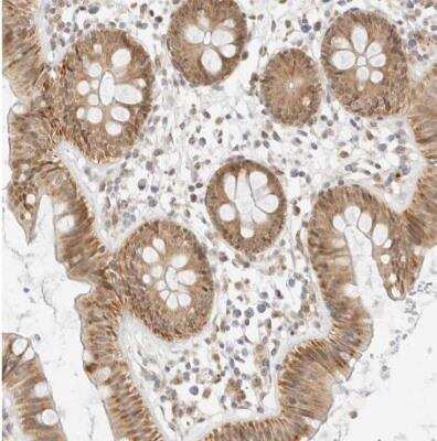 Immunohistochemistry-Paraffin: SCYL1BP1 Antibody [NBP1-92371]