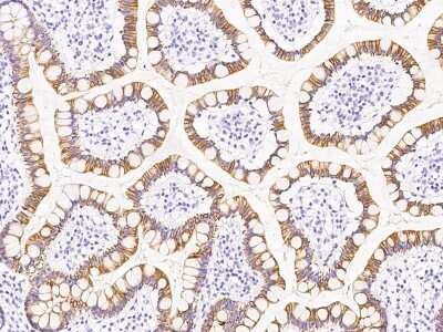 Immunohistochemistry-Paraffin: SCYL1BP1 Antibody [NBP2-97159]
