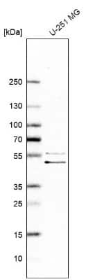 Western Blot: SCYL1BP1 Antibody [NBP1-92370]