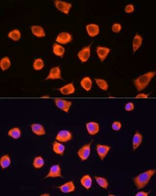 Immunocytochemistry/ Immunofluorescence: SCYL2 Antibody - Azide and BSA Free [NBP2-93622]