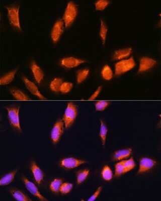 Immunocytochemistry/ Immunofluorescence: SCYL2 Antibody - Azide and BSA Free [NBP2-93622]