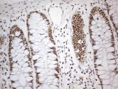 Immunohistochemistry: SDCCAG10 Antibody (OTI4C8) [NBP2-46409]