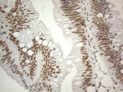Immunohistochemistry: SDCCAG10 Antibody (OTI4C8) [NBP2-46409]