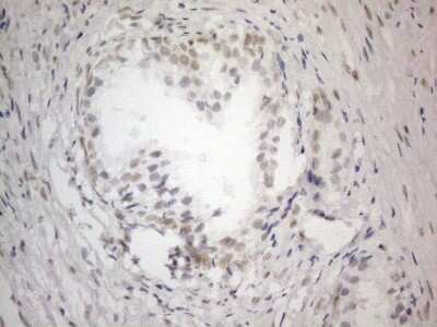 Immunohistochemistry: SDCCAG10 Antibody (OTI4C8) [NBP2-46409]
