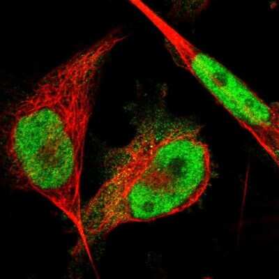 Immunocytochemistry/ Immunofluorescence: SDCCAG10 Antibody [NBP1-82508]