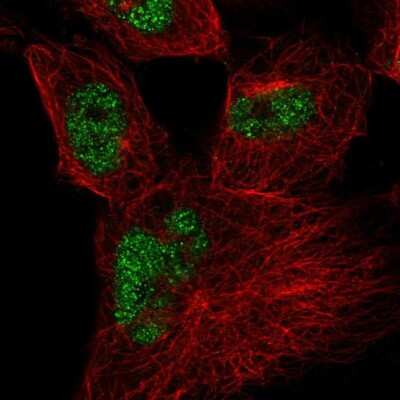 Immunocytochemistry/ Immunofluorescence: SDCCAG10 Antibody [NBP2-56438]