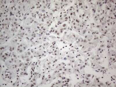 Immunohistochemistry: SDCCAG10 Antibody (OTI4C8) - Azide and BSA Free [NBP2-74031]