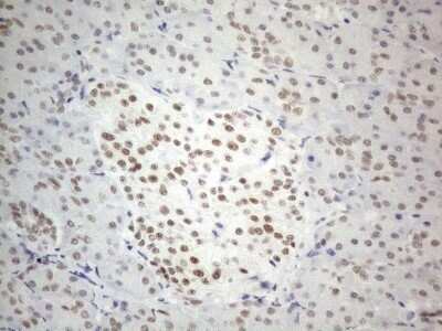 Immunohistochemistry: SDCCAG10 Antibody (OTI4C8) - Azide and BSA Free [NBP2-74031]