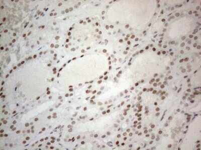 Immunohistochemistry: SDCCAG10 Antibody (OTI4C8) - Azide and BSA Free [NBP2-74031]