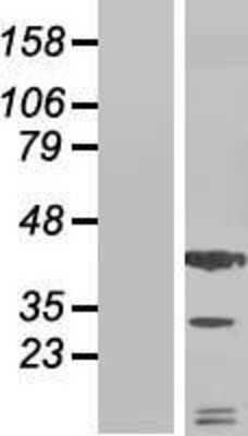 Western Blot: CXCL12/SDF-1 Overexpression Lysate [NBP2-10687]