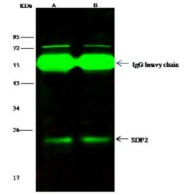 Immunoprecipitation: SDF2 Antibody [NBP2-98245]