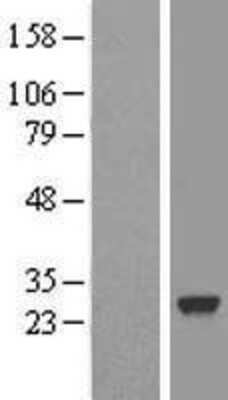 Western Blot: SDF2 Overexpression Lysate [NBL1-15764]