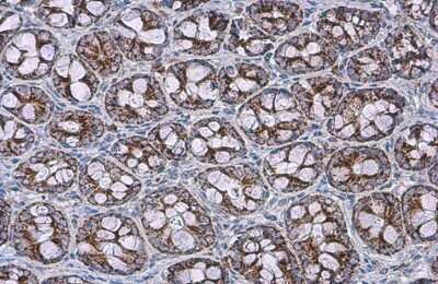 Immunohistochemistry-Paraffin: SDHA Antibody (GT20710) [NBP3-13522]