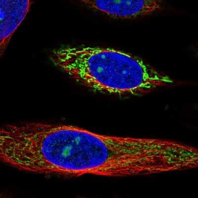 Immunocytochemistry/ Immunofluorescence: SDHA Antibody [NBP2-56988]