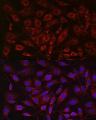 Immunocytochemistry/ Immunofluorescence: SDHA Antibody - Azide and BSA Free [NBP2-93922]